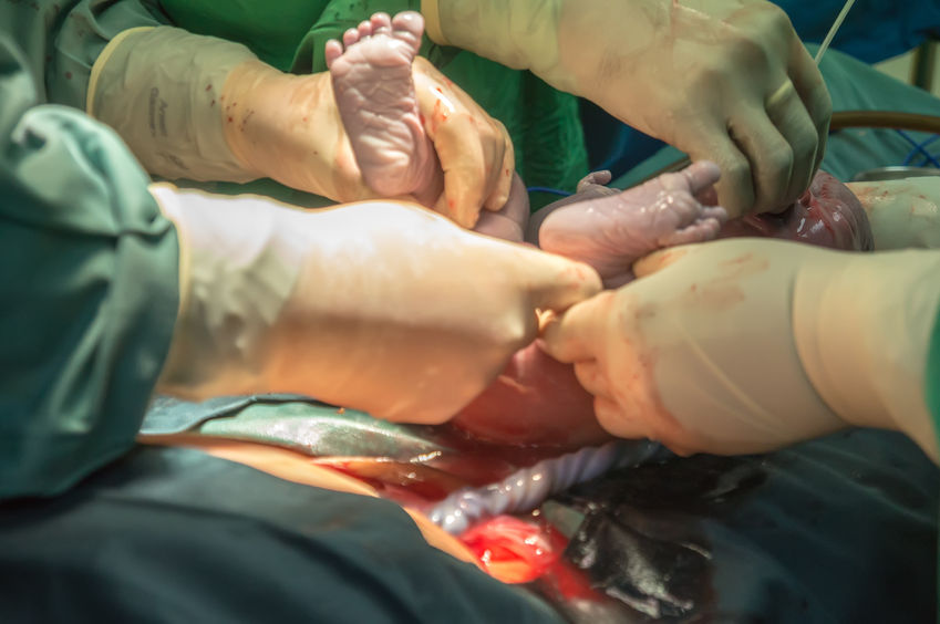 Birth Plan – C Section